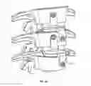 Fig. 11 - Intervertebral disc implant