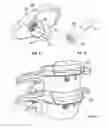 Fig. 15 - Intervertebral disc implant