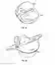 Fig. 19 - Intervertebral disc implant