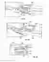 Fig. 31 - Intervertebral disc implant