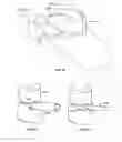 Fig. 34 - Intervertebral disc implant