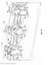 Fig. 56 - Intervertebral disc implant
