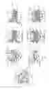 Fig. 02 - Cervical disc replacement