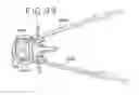 Fig. 15 - Spinal tissue distraction devices