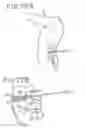 Fig. 24 - Spinal tissue distraction devices