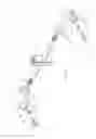 Fig. 10 - Lateral distractor