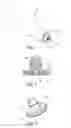 Fig. 02 - Prosthetic liner and prosthetic shaft system comprising prosthetic liner and prosthetic shaft