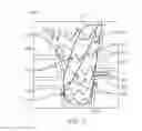 Fig. 08 - Devices and methods for treating aneurysms and other vascular conditions