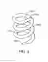 Fig. 10 - Devices and methods for treating aneurysms and other vascular conditions