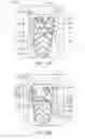 Fig. 14 - Devices and methods for treating aneurysms and other vascular conditions