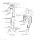 Fig. 15 - Devices and methods for treating aneurysms and other vascular conditions