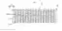 Fig. 01 - Stent, method for producing same and device for producing same