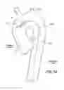 Fig. 03 - Vascular graft device placement methods