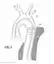 Fig. 07 - Vascular graft device placement methods