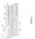 Fig. 06 - Rapid exchange stent delivery system