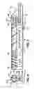 Fig. 05 - METHOD AND SYSTEM FOR CONTROLLED STENT DEPLOYMENT and RECONSTRAINT