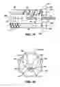 Fig. 10 - METHOD AND SYSTEM FOR CONTROLLED STENT DEPLOYMENT and RECONSTRAINT