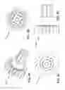 Fig. 07 - METHODS AND SYSTEMS FOR DELIVERING AN IMPLANT