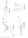 Fig. 06 - METHODS AND SYSTEMS FOR DELIVERING AN IMPLANT