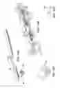 Fig. 14 - METHODS AND SYSTEMS FOR DELIVERING AN IMPLANT