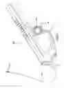 Fig. 02 - Methods and systems for delivering an implant