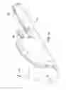 Fig. 15 - Methods and systems for delivering an implant