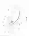 Fig. 14 - Elbow orthosis