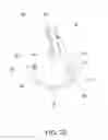 Fig. 16 - Elbow orthosis