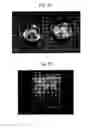 Fig. 17 - Eye Care Devices and Methods