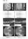 Fig. 08 - USE OF PEDF IN AN ENCAPSULATED CELL-BASED DELIVERY SYSTEM