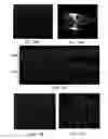 Fig. 26 - WOUND DRESSING SEALANT AND USE THEREOF
