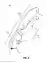 Fig. 02 - Personal massager with undulating arm