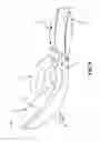 Fig. 06 - Personal massager with undulating arm