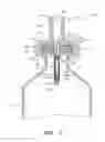 Fig. 06 - Devices and methods for transferring medicinal fluid to or from a container