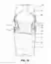 Fig. 11 - Baby bottle