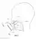 Fig. 04 - Infant feeding teat
