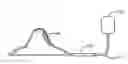 Fig. 01 - Breastfeeding apparatus system
