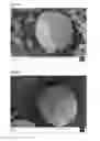 Fig. 10 - Process for producing microcapsules comprising an active component encapsulated, protected and stabilised within a protein shell