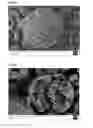 Fig. 11 - Process for producing microcapsules comprising an active component encapsulated, protected and stabilised within a protein shell