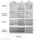 Fig. 06 - COMPOSITION AND METHOD FOR TREATING AND RELIEVING MYOPIA