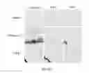 Fig. 08 - COMPOSITION AND METHOD FOR TREATING AND RELIEVING MYOPIA