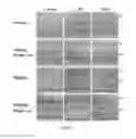 Fig. 10 - COMPOSITION AND METHOD FOR TREATING AND RELIEVING MYOPIA