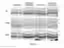 Fig. 11 - COMPOSITION AND METHOD FOR TREATING AND RELIEVING MYOPIA