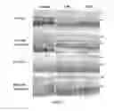 Fig. 12 - COMPOSITION AND METHOD FOR TREATING AND RELIEVING MYOPIA