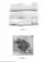 Fig. 13 - COMPOSITION AND METHOD FOR TREATING AND RELIEVING MYOPIA