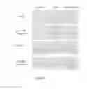 Fig. 15 - COMPOSITION AND METHOD FOR TREATING AND RELIEVING MYOPIA