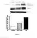 Fig. 24 - COMPOSITION AND METHOD FOR TREATING AND RELIEVING MYOPIA