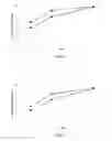 Fig. 03 - Use of sustained release dexamethasone in post-cataract surgery inflammation