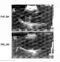 Fig. 05 - Anti-infective hydroxy-phenyl-benzoates and methods of use