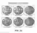 Fig. 20 - Anti-infective hydroxy-phenyl-benzoates and methods of use